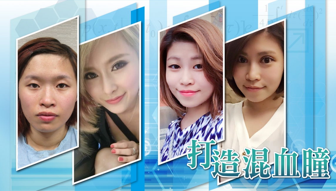 混血瞳案例 混血瞳案例